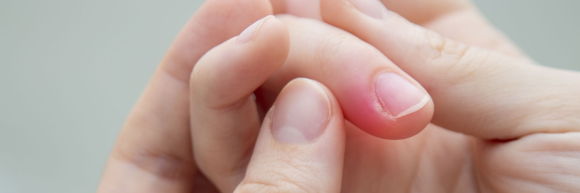 West Palm Beach Finger Pain Causes, Treatment | Wellington Finger Injury  Treatment